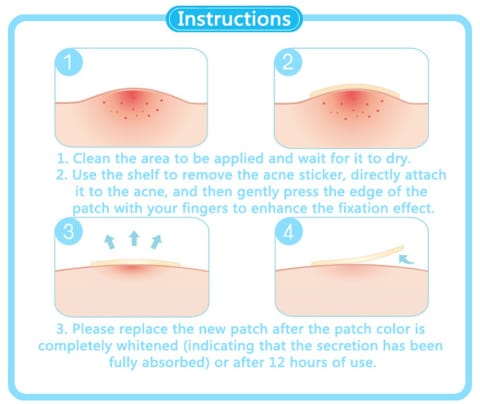 Beauty Acne Patch Set (24 PCS)