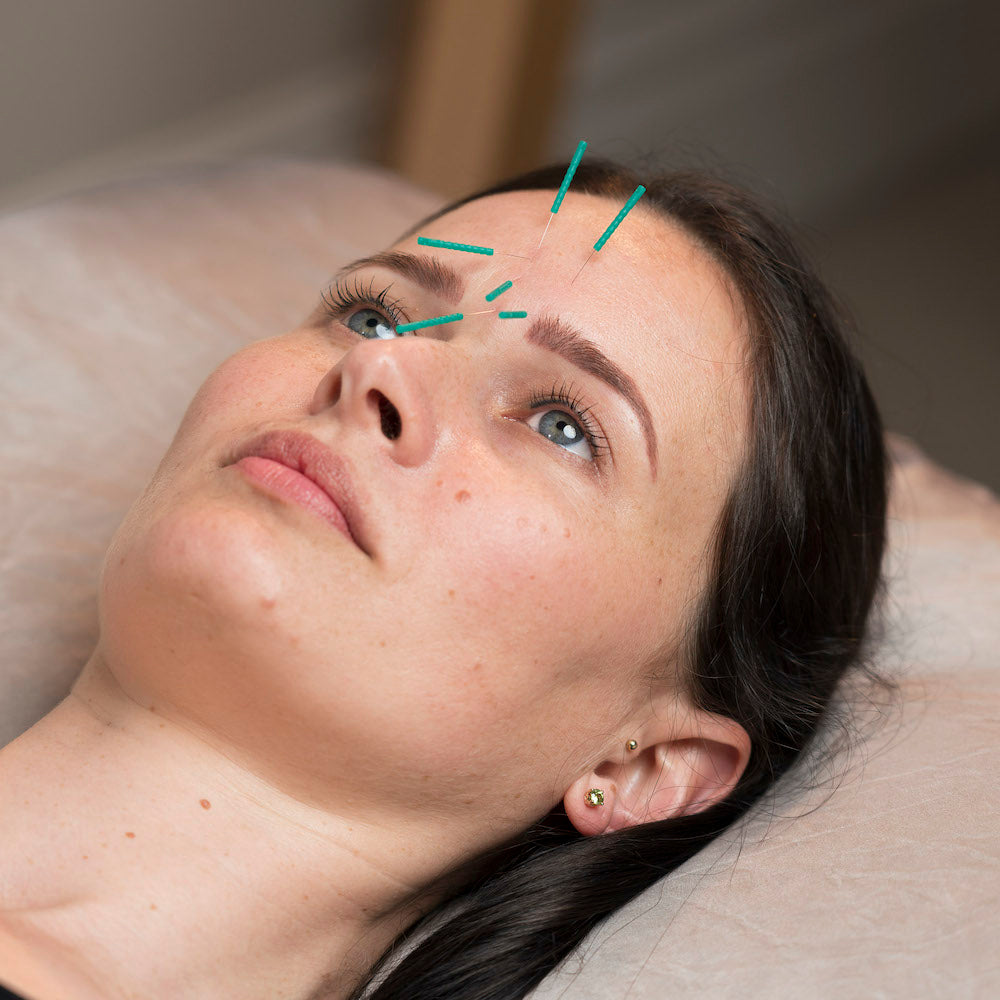 White Lotus Cosmetic Acupuncture Training Online