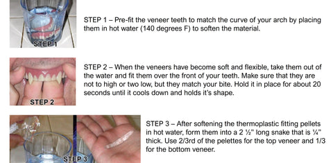 Dental Distortions Wolfe FX Custom fit veneers application instructions tutorial