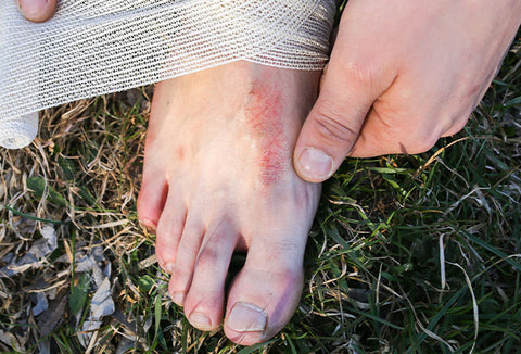 A person wrapping their foot on the trail.