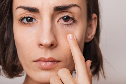 Mujer con ojos rojos