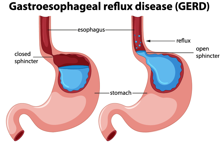 <a href="https://www.vecteezy.com/free-vector/stomach">Stomach Vectors by Vecteezy</a>