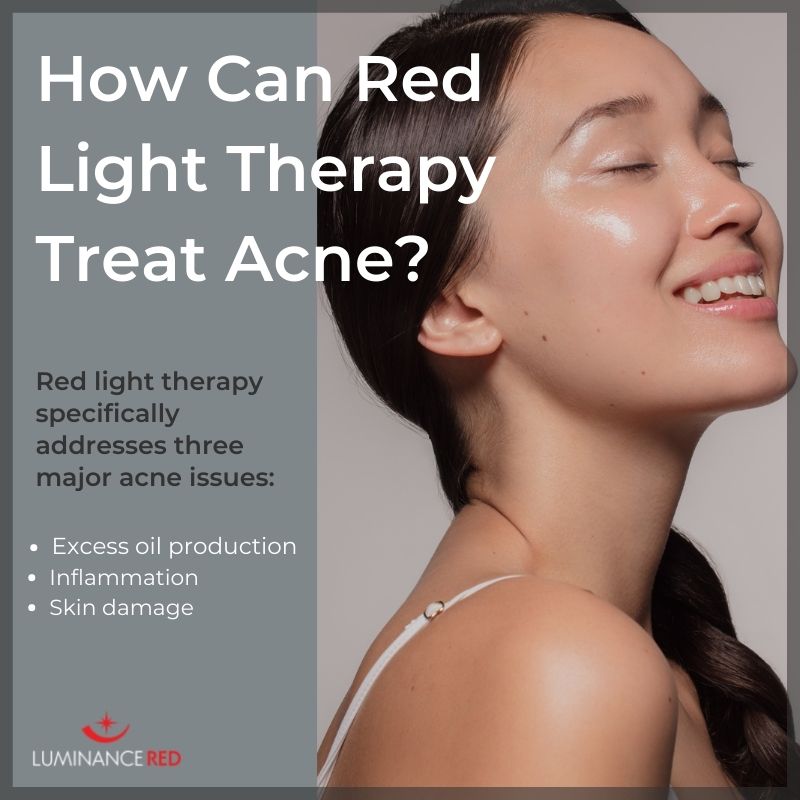 Does red LED help with pimples?