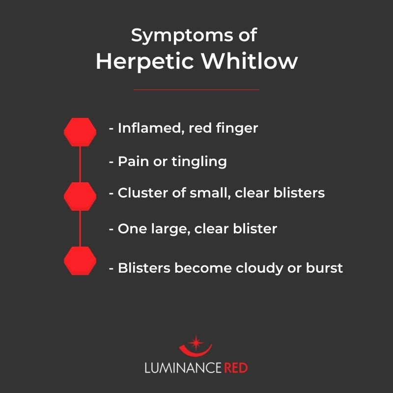 Herpetic whitlow occurs when a cut or abrasion on a person's finger comes into contact with a herpes virus and becomes infected.