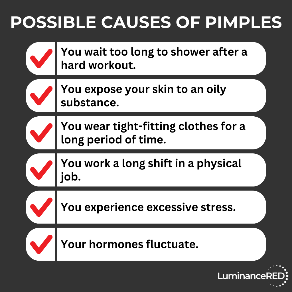 Infographic: Acne vs. Pimples: How to Tell the Difference