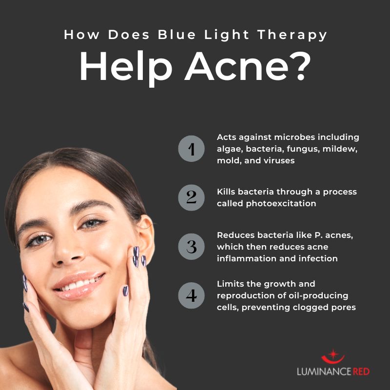 Which light kills acne?