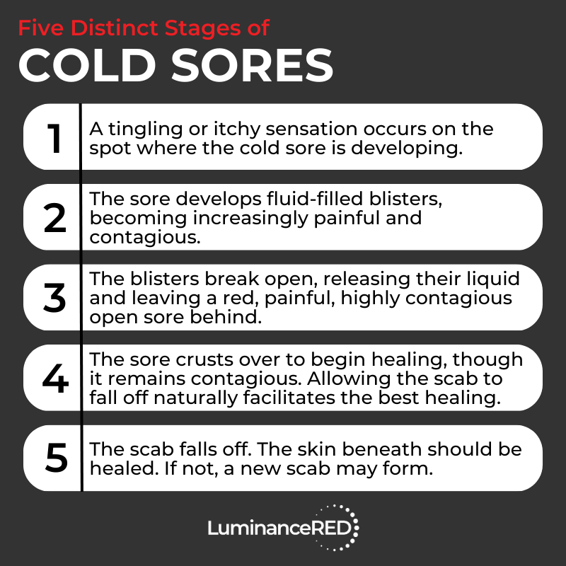 Image result for 5 Signs Your Cold Sore Is Serious infographics