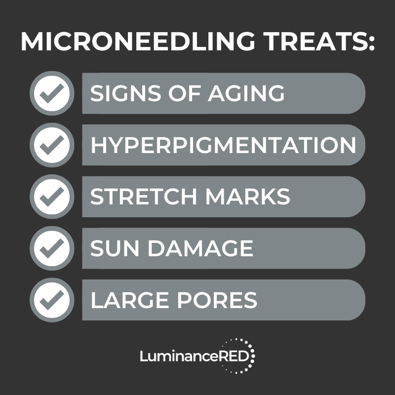 Infographic: Microneedling for Acne Scars: What You Need to Know
