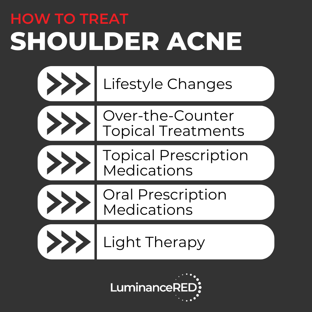 Infographic: Shoulder Acne: Everything You Need to Know