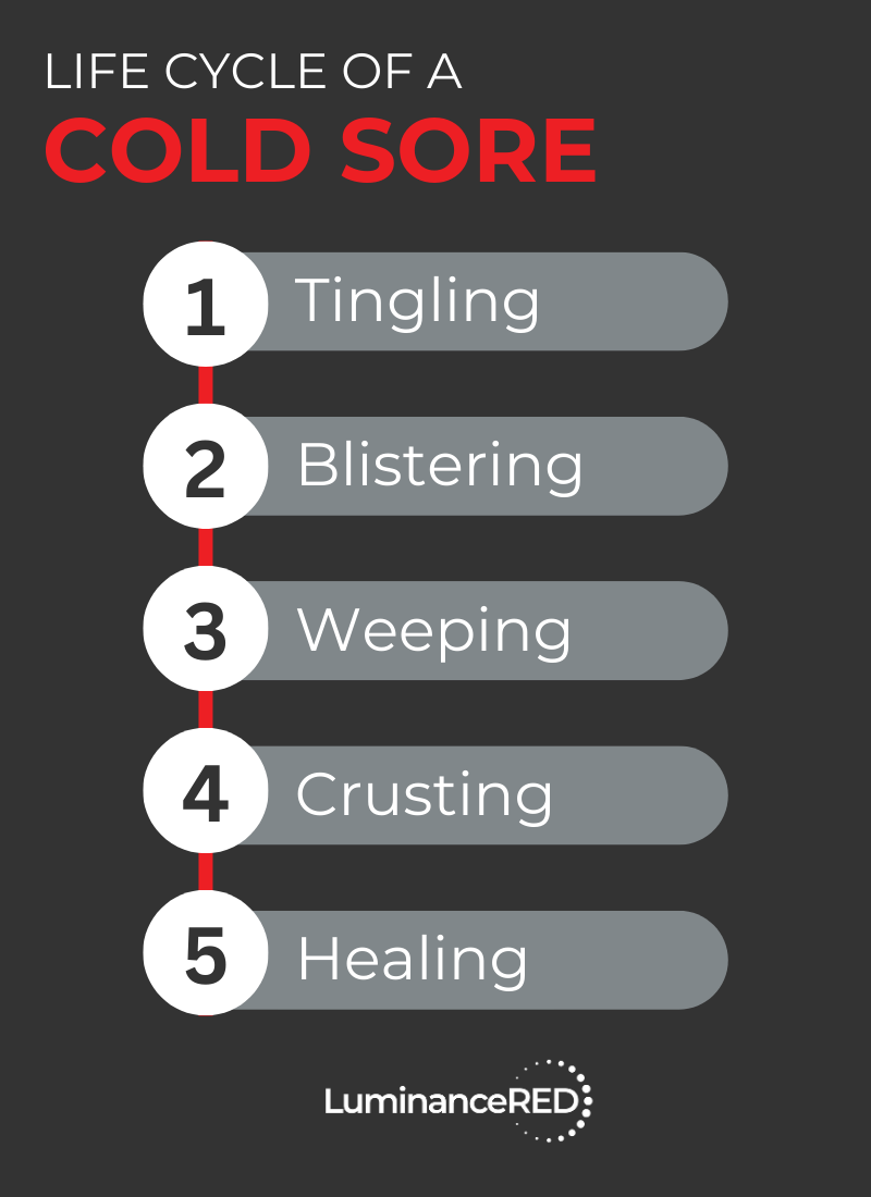 Infographic: The Top 5 OTC Cold Sore Treatments Compared