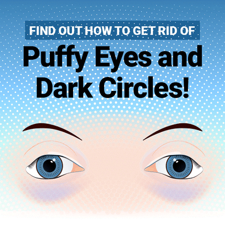 Puffy Eyes & Dark Circles- Quick Tips