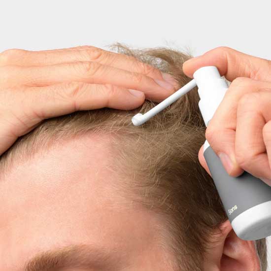 studieafgift salgsplan skadedyr Buy 5% Minoxidil Lotion for Hair Loss – Sons UK