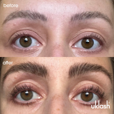 Eyebrow growth serum before & after images