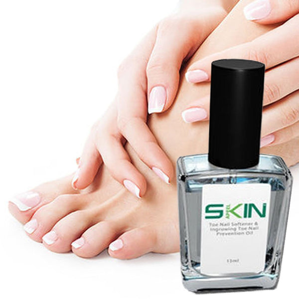 Skinapeel Toe Nail Softener and Ingrowing Toenail Prevention Oil 0