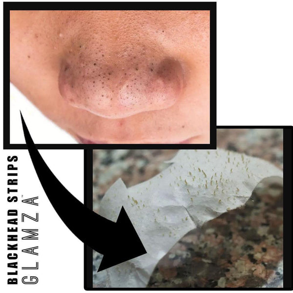 Glamza Blackhead Removal Strips 4