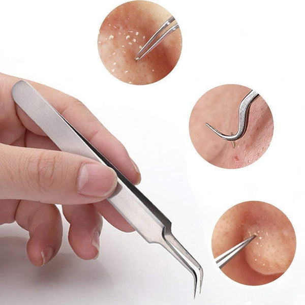 Glamza Blackhead Removal Claw 2