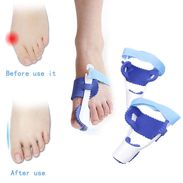 Glamza Splint Corrector Device 1