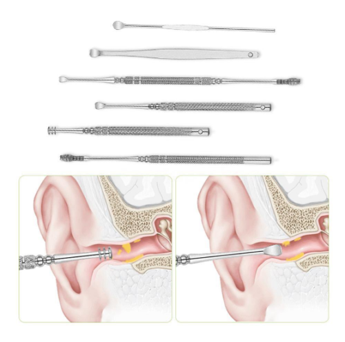 Glamza - 6pc Ear Wax Removal Kit 5