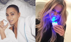 Do teeth whitening kits really work