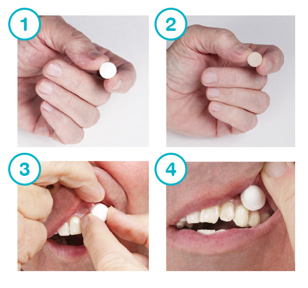 xylimelts pastille shown placed on molar white side towards cheek