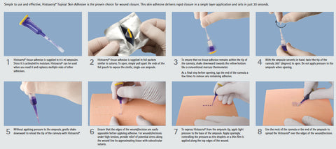 Medical Supermarket, Histoacryl Adhesive Blue