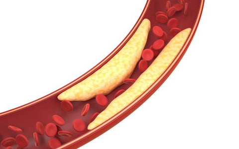 Cholesterol Alone Is Not the Only Culprit of Heart Problems 