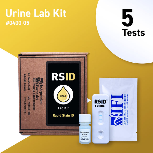 Product Image of 0400 - 05 | RSID URINE with buffer 5 Tests/Kit #1