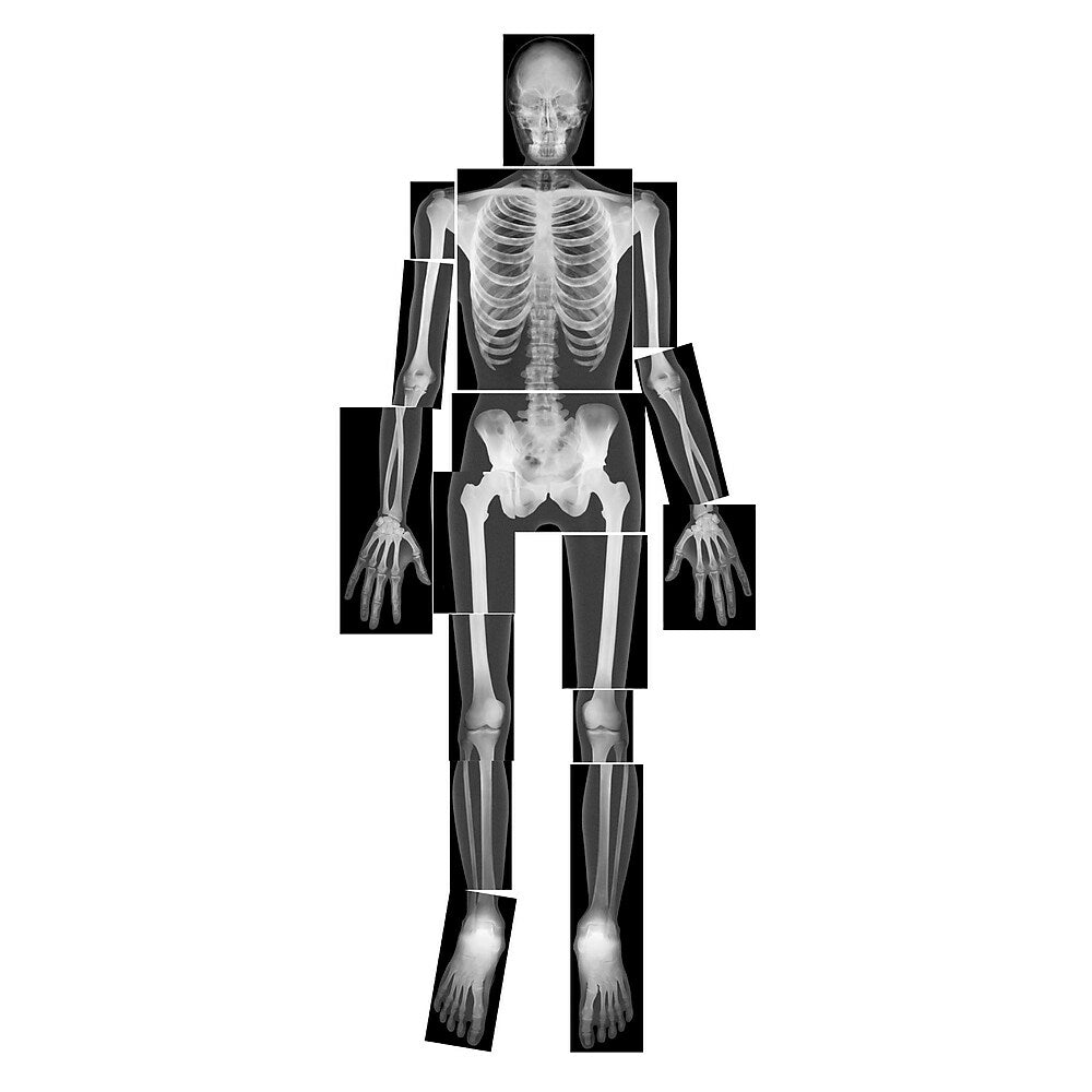 Image of Roylco True To Life Human X-Ray
