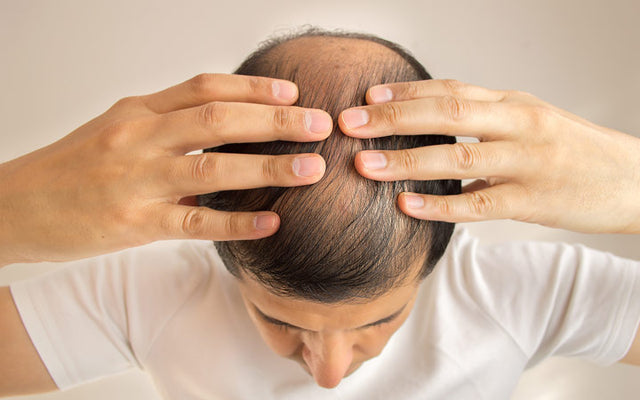 Top Ayurvedic remedies to control hair fall