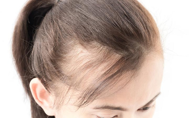 How To Handle A Mature Hairline  Nutrafol