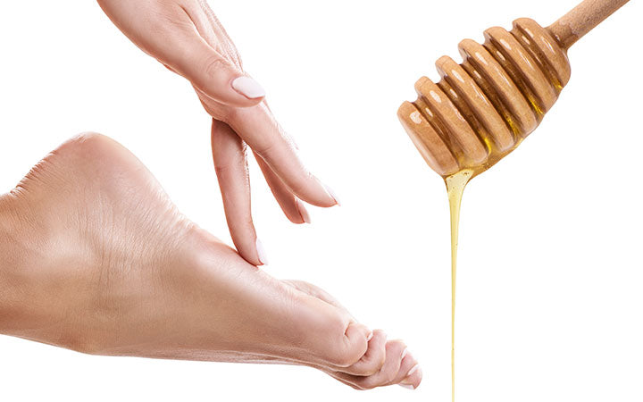 Cracked Heels: Causes, Treatment, Prevention | ClearSkin