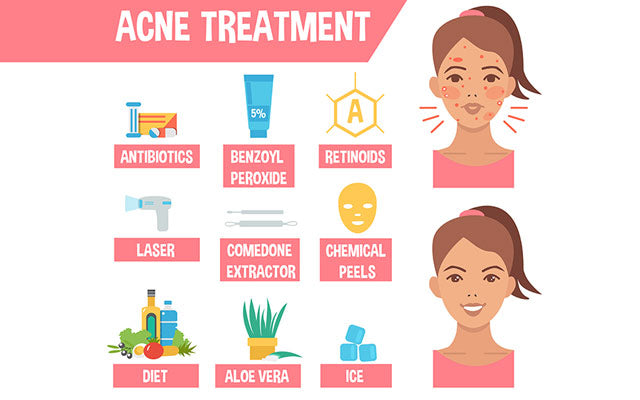acne treatment procedures