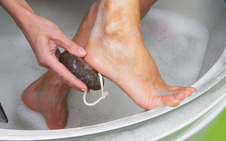 Best Home Remedies for Cracked Heel - PharmEasy Blog