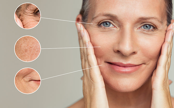 Wrinkles: Causes, Types, Treatment & Prevention – Vedix