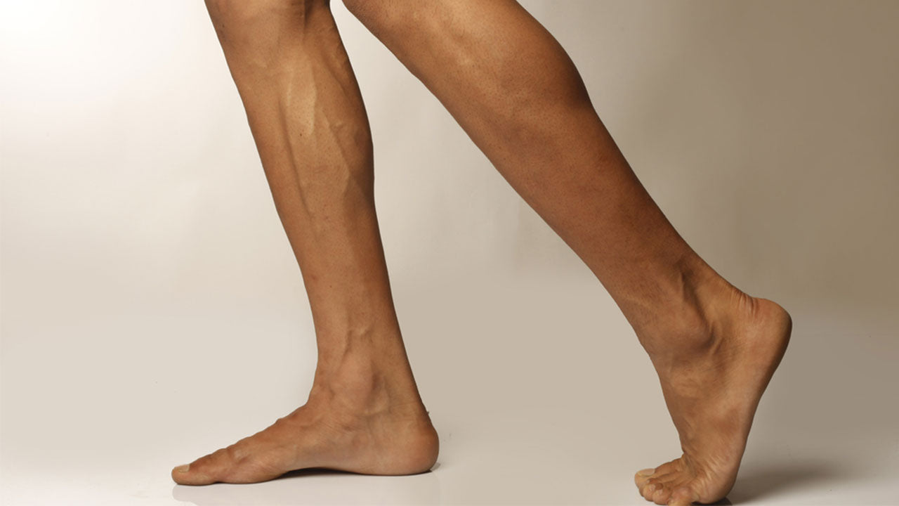 Pulled, Torn Calf Muscle Recovery Time: How to Heal Your Lower Leg