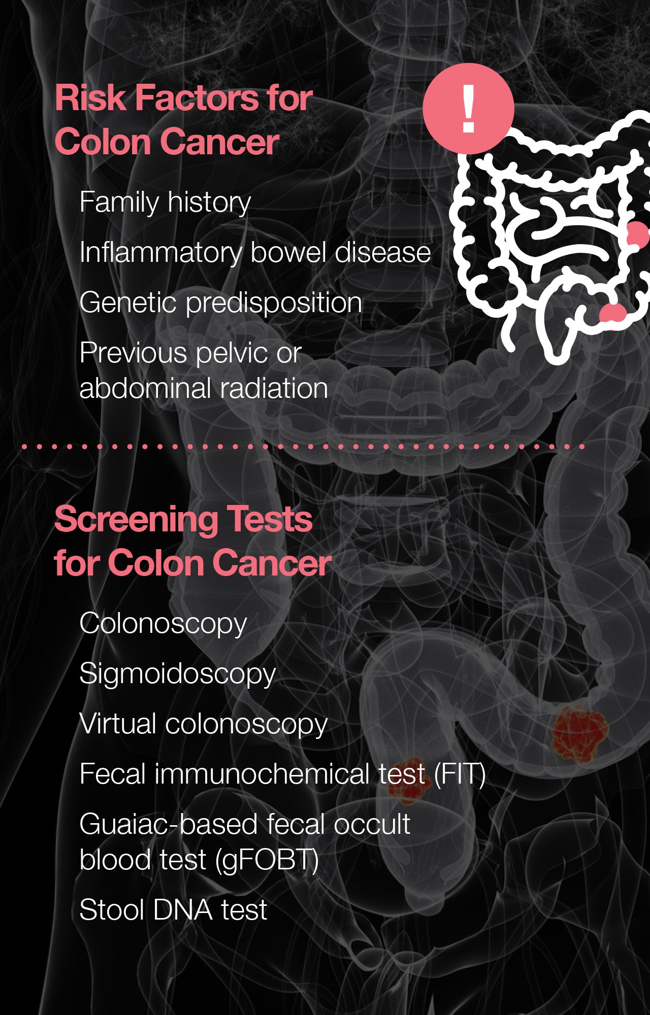 Signs of colon cancer