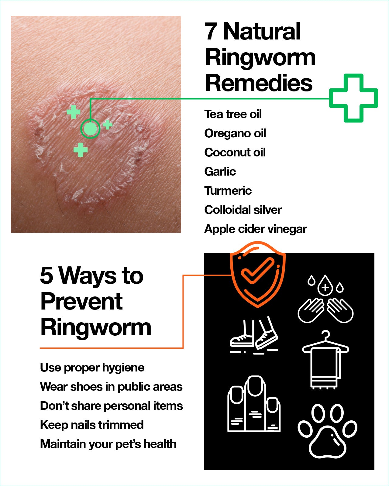 Ringworm Diagram