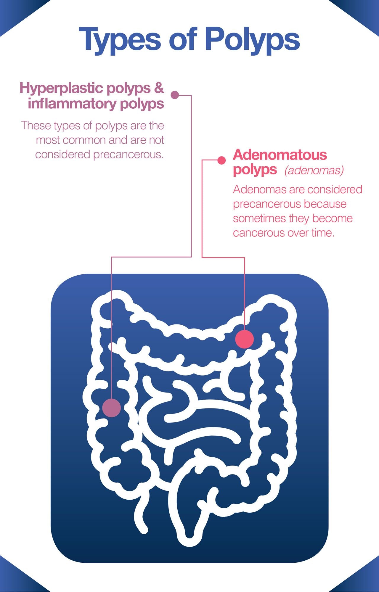 Most colon cancers are caused by polyps.