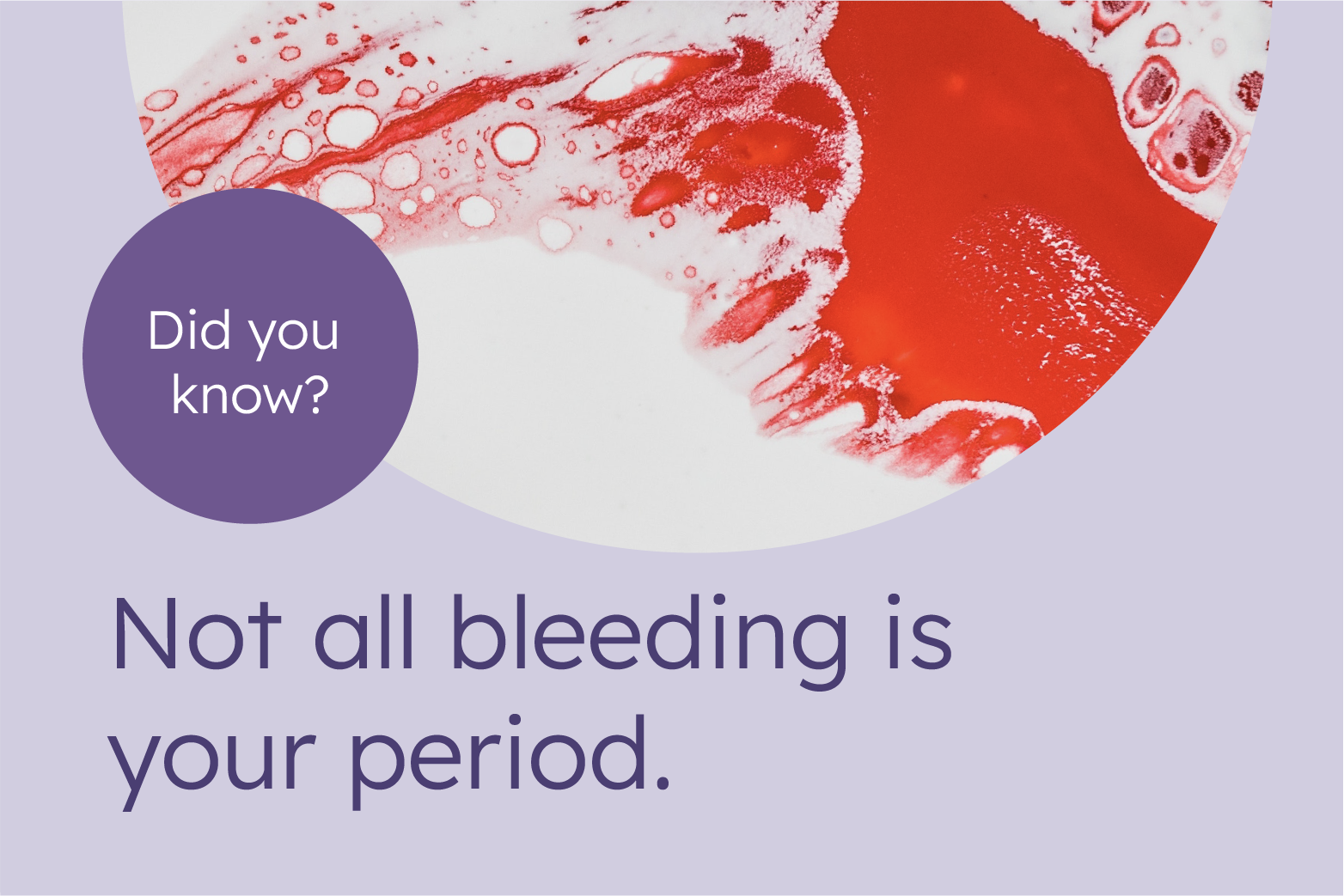 Spotting instead of period? Find out why it happens here