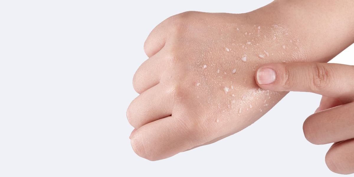 What is exfoliating skin?