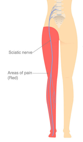 diagram of a leg with sciatic nerve