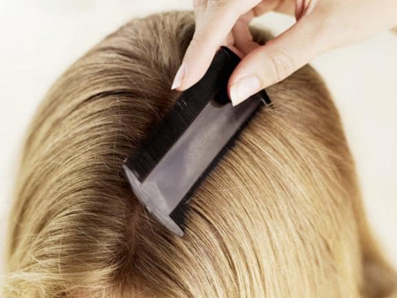 What Do Lice Look Like In Blonde Hair And Ways To Remove Them