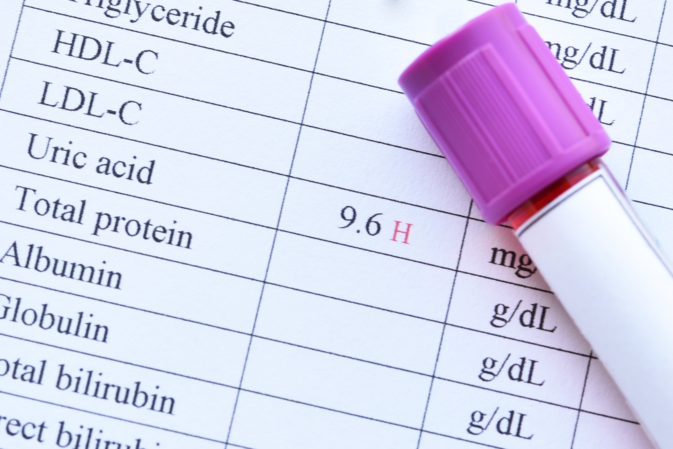 Uric acid levels recorded on a medical chart