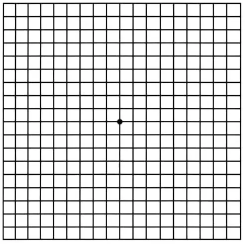 AMD Amsler grid checkered table with dot in the center