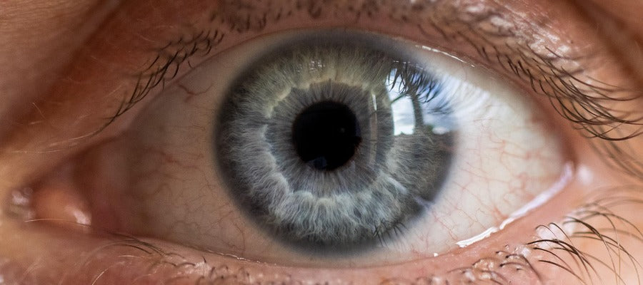 closeup of male blue eye affected by dry eye disease and slight redness