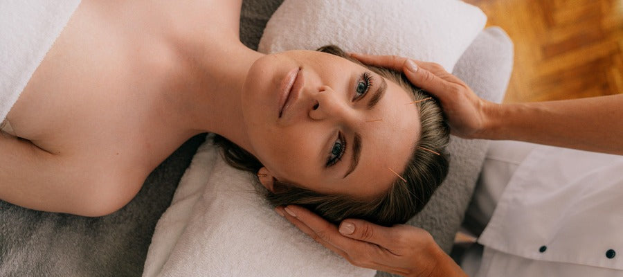 woman with blue eyes lying with head on white towel undergoing acupuncture on her forehead