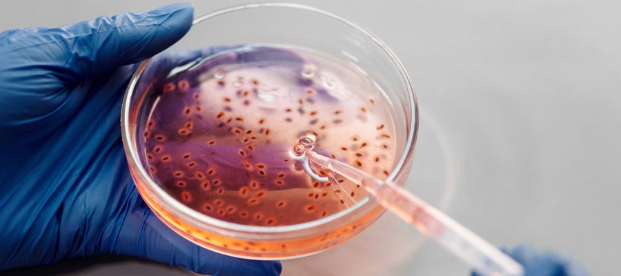 open Petri dish with microorganisms in it held in one gloved hand while the other hand empties a pipette into it