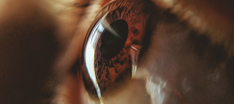 closeup of shiny surface of a human brown eye