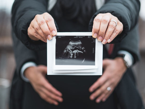 person holding an ultrasound image of their baby