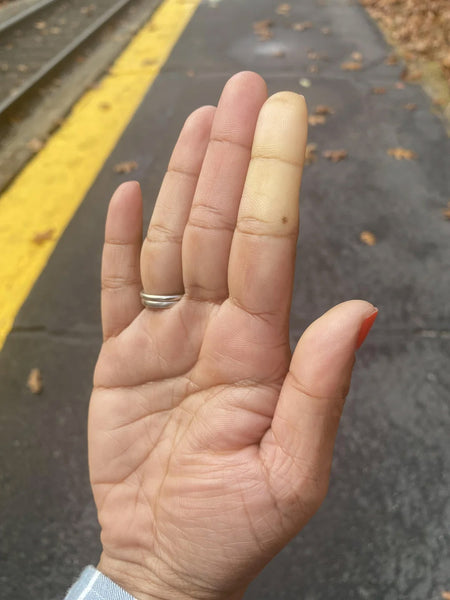 advice for Raynaud's Patient 11